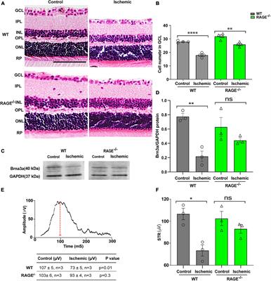 RAGE and its ligand amyloid beta promote retinal ganglion cell loss following ischemia-reperfusion injury